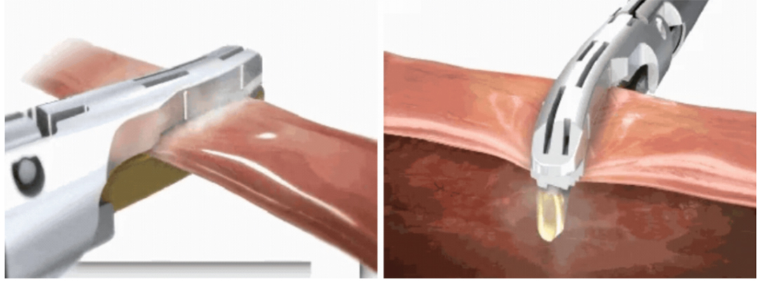 Working Principle Working Principle